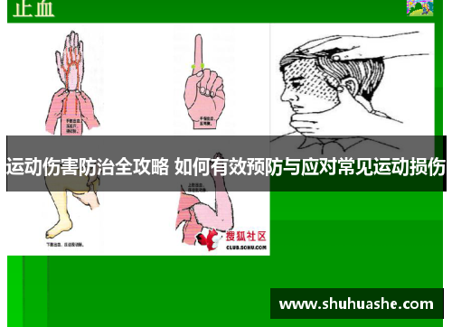 运动伤害防治全攻略 如何有效预防与应对常见运动损伤